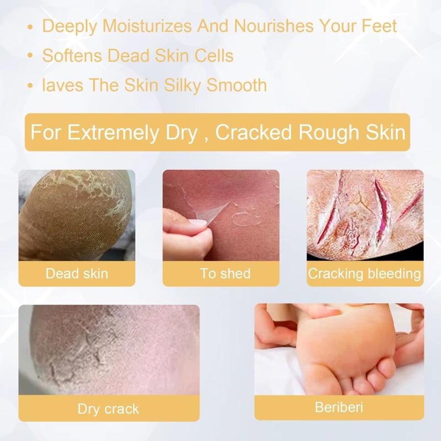Ouhoe رذاذ تقشير القدم 72H قفل الرطوبة الكالس المنقي مكافحة الكراك الجاف إصلاح رائحة التحكم اشراق العناية بالقدم السائل