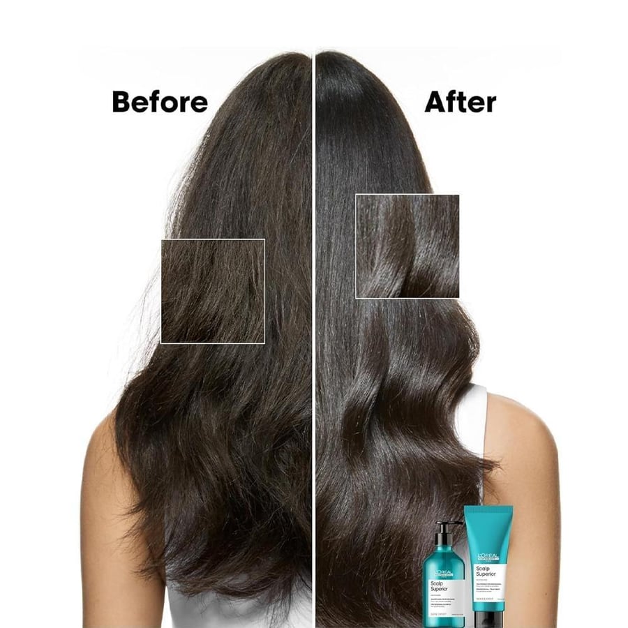 L'Oréal Professionnel Scalp Advanced Anti-Oil Shampoo – 500 ml