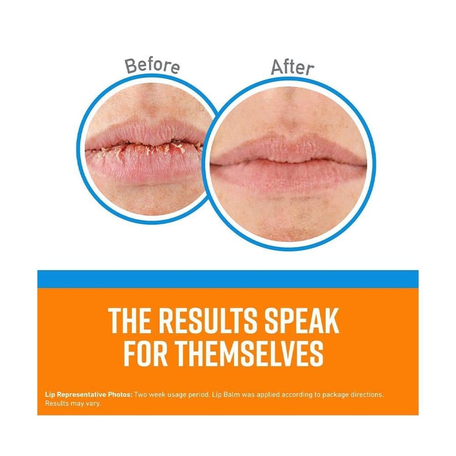 او كيفيز مرطب استيك للشفاة 4.2 جرام كول O KEEFFES LIP REPAIR 4.2 GM COOLING (071010)