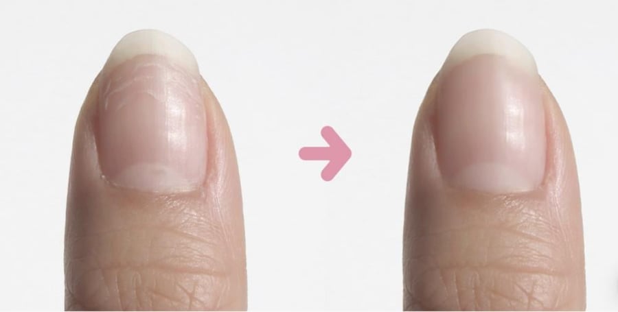 Dear.A  Luminous Nail Essence المعالج  الكوري لتقوية اﻷظلفر و تطويلها