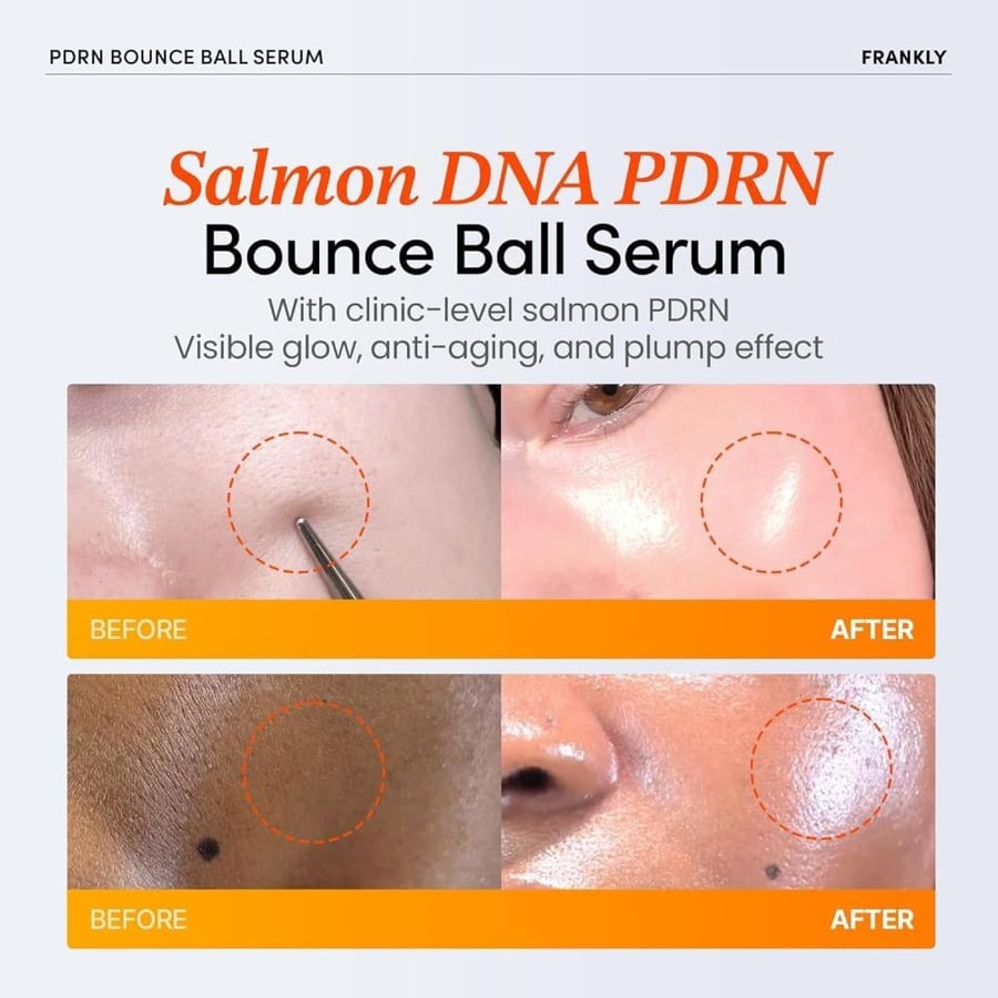 FRANKLY PDRN Bounce Ball Serum 30ml سيروم السلمون الكوري