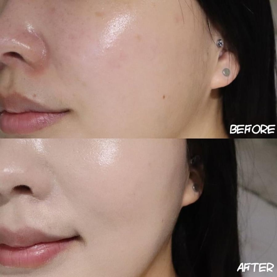 نمبزن أمبولة مركزه للتفتيح خلال أسبوعين numbuzin no.5 glutathione txa advanced dark spot ampoule concentrate