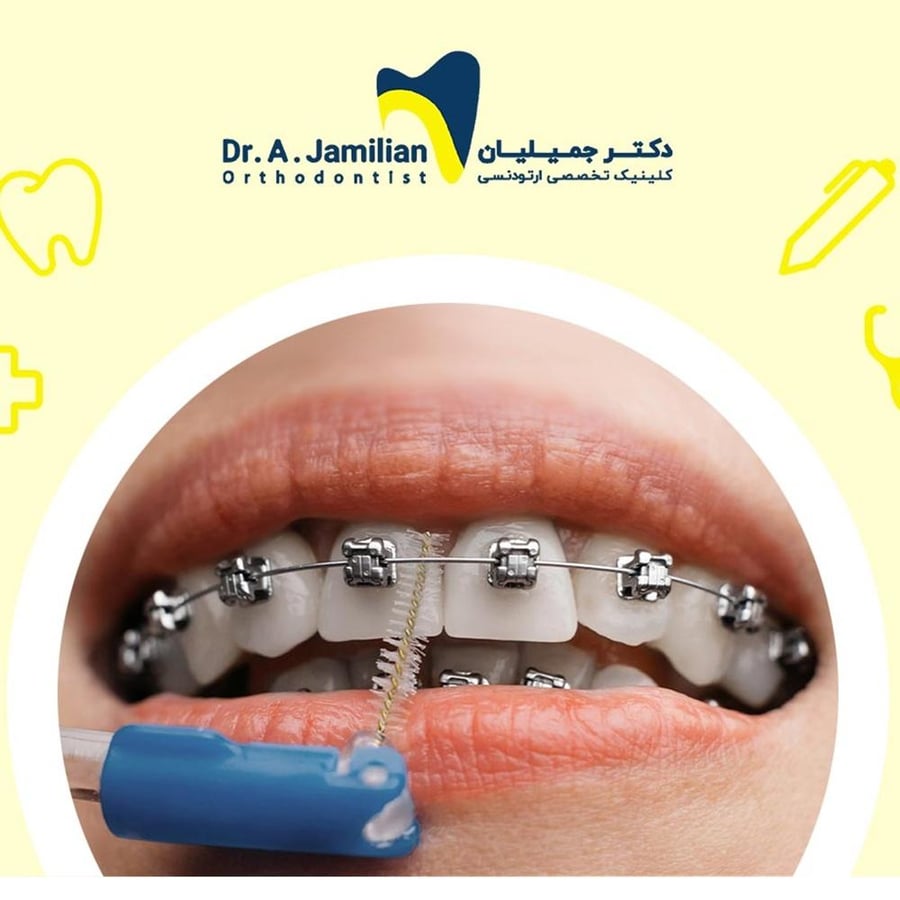 دكتور بروش فرشاة التنظيف للتقويم وبين الأسنان - 4 قطع