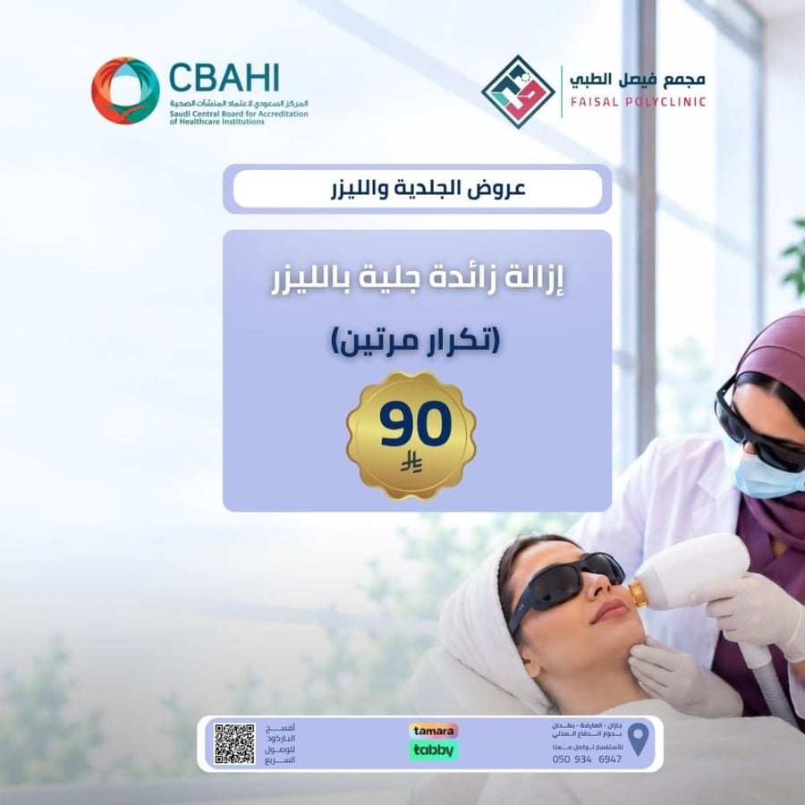 إزالة زائدة جلدية بالليزر