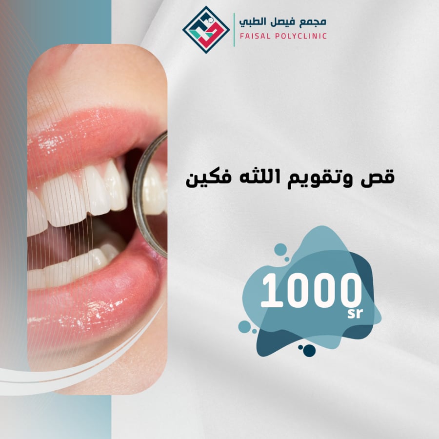 قص وتقويم اللثه فكين