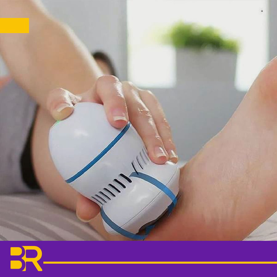Dead skin removal and exfoliation device