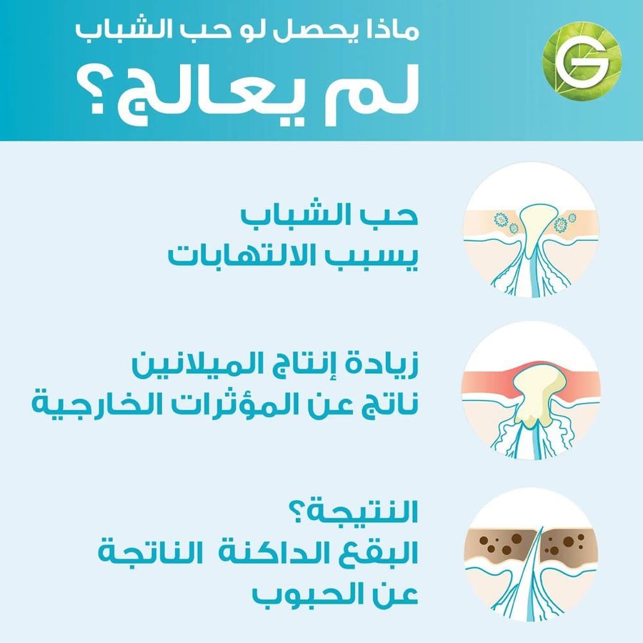 سيروم تنقية بحمض الساليسيليك للوجه 15 مل موديل 6783
