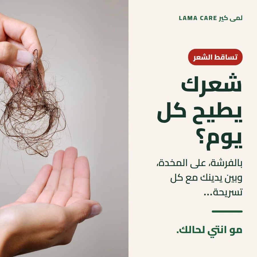 خصلة شعر متساقطة بين اليدين بسبب تساقط الشعر اليومي