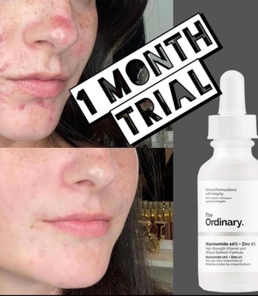ذا اورديناري سيروم مكافحة التصبغات و المسام - The Ordinary Niacinamide 10% + Zinc 1% -