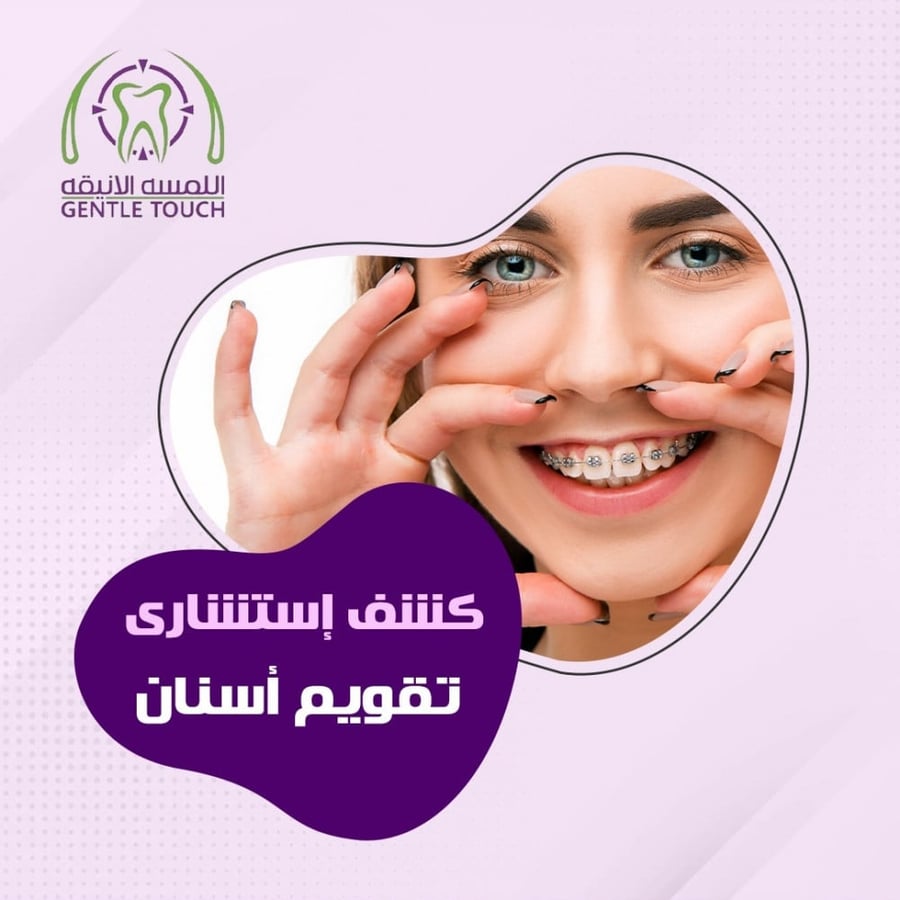 كشف استشاري تقويم