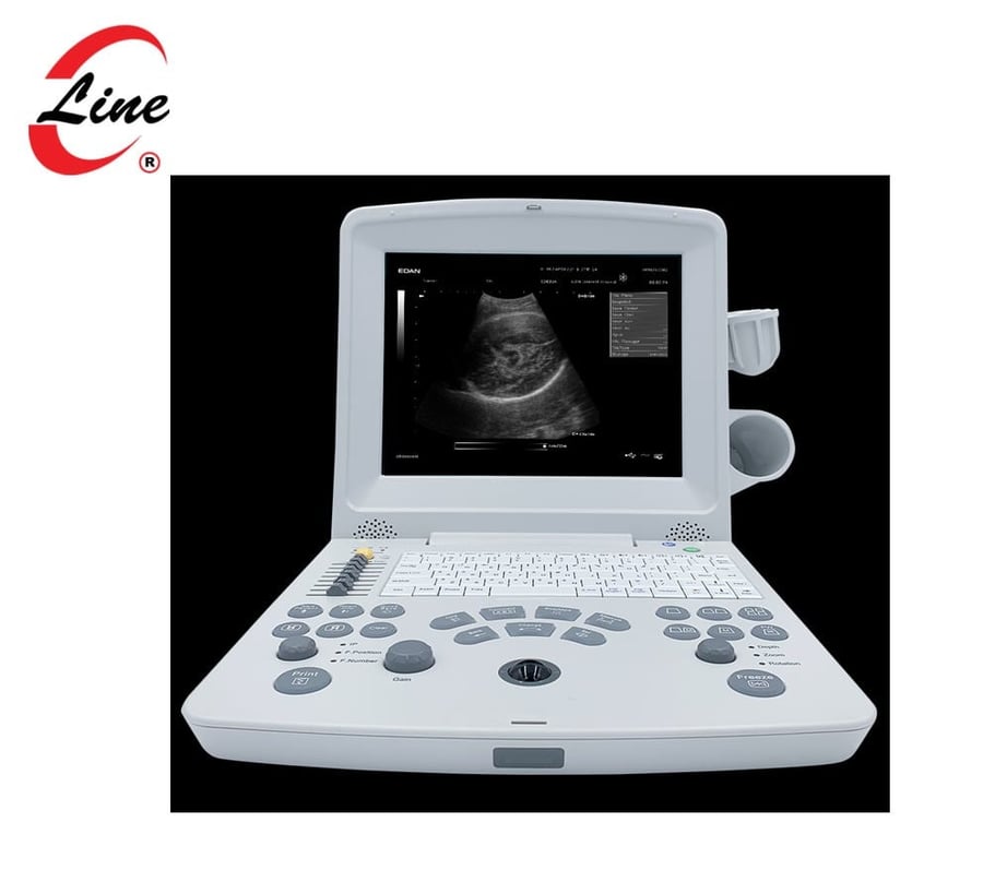 Diagnostic Ultrasound - DUS60 Digital Ultrasonic Diagnostic Vet System