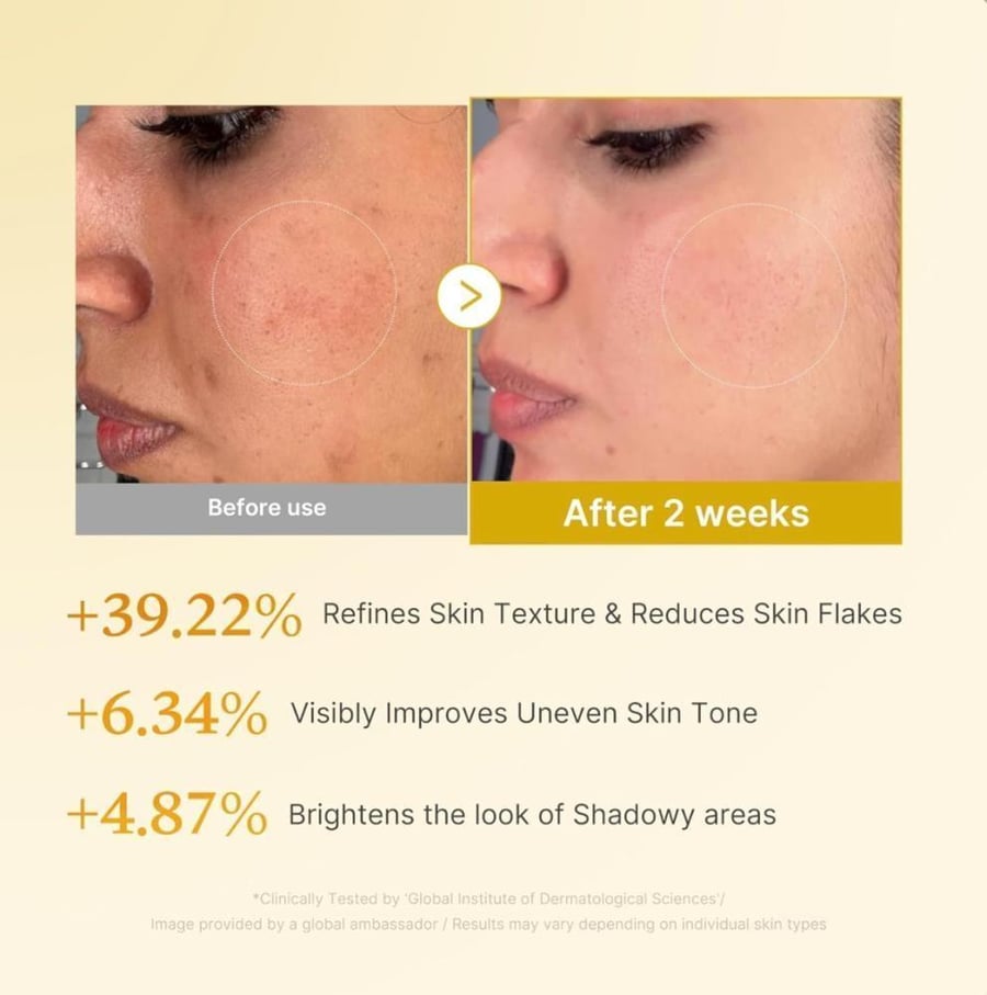 مجموعة الإشراقة الذهبية بالكوجيك Golden Glow Kojic Set