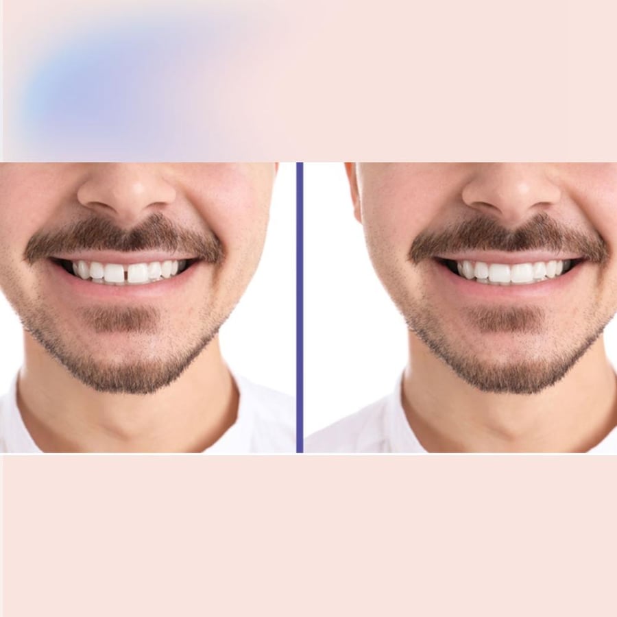 اقفال الفراغات