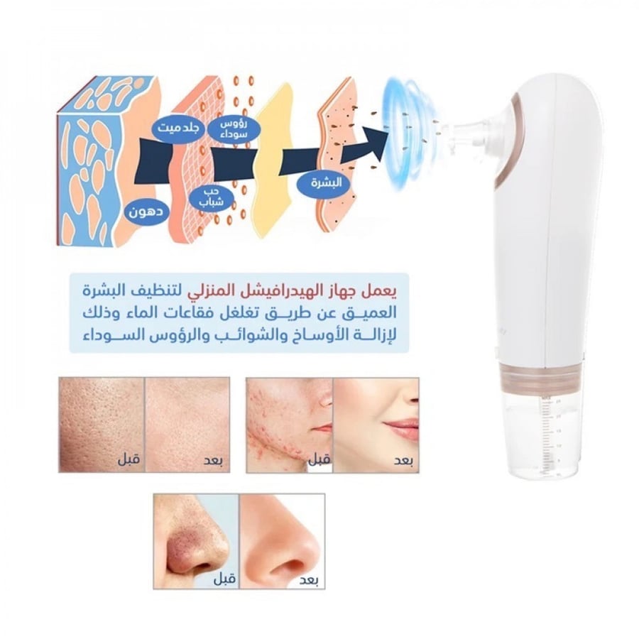 Home Hydrofacial device