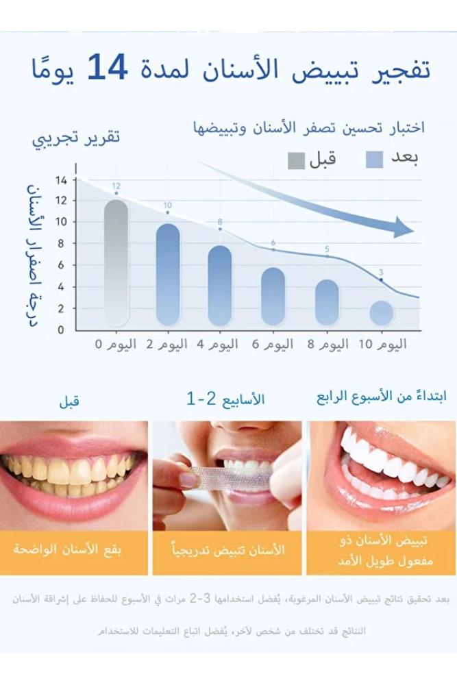 L&Wen شرائط تبييض الأسنان 5D White - 14 زوجًا