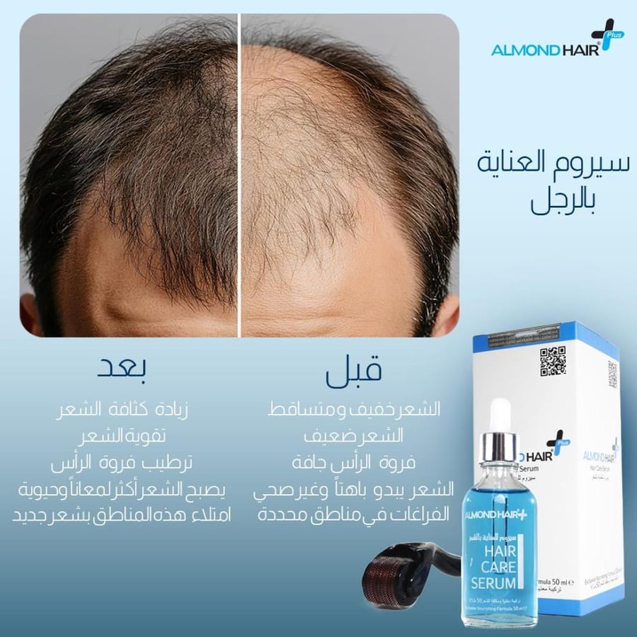 مجموعة مستلزمات نمو الشعر للرجال من الموندهير