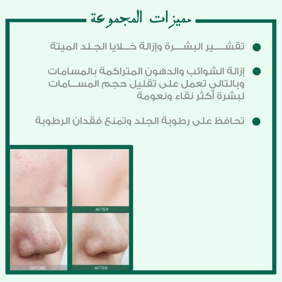 مجموعة العناية 30 Days Miracle بالأحماض AHA BHA PHA علاج حب الشباب