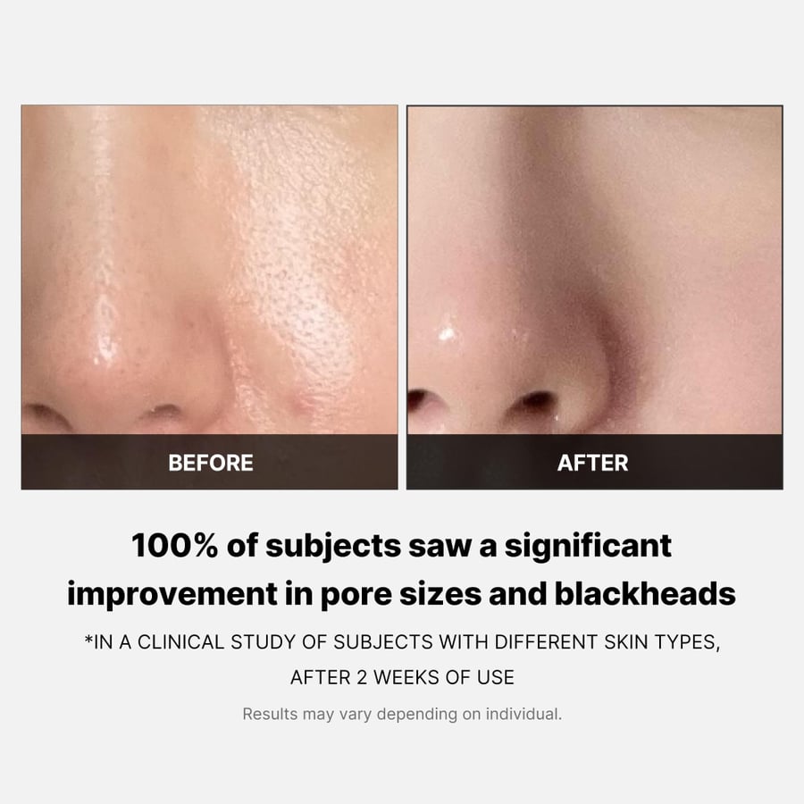 medicube - Zero Pore Pad 2.0 مسحات زيرو باد من ميدي كيوب
