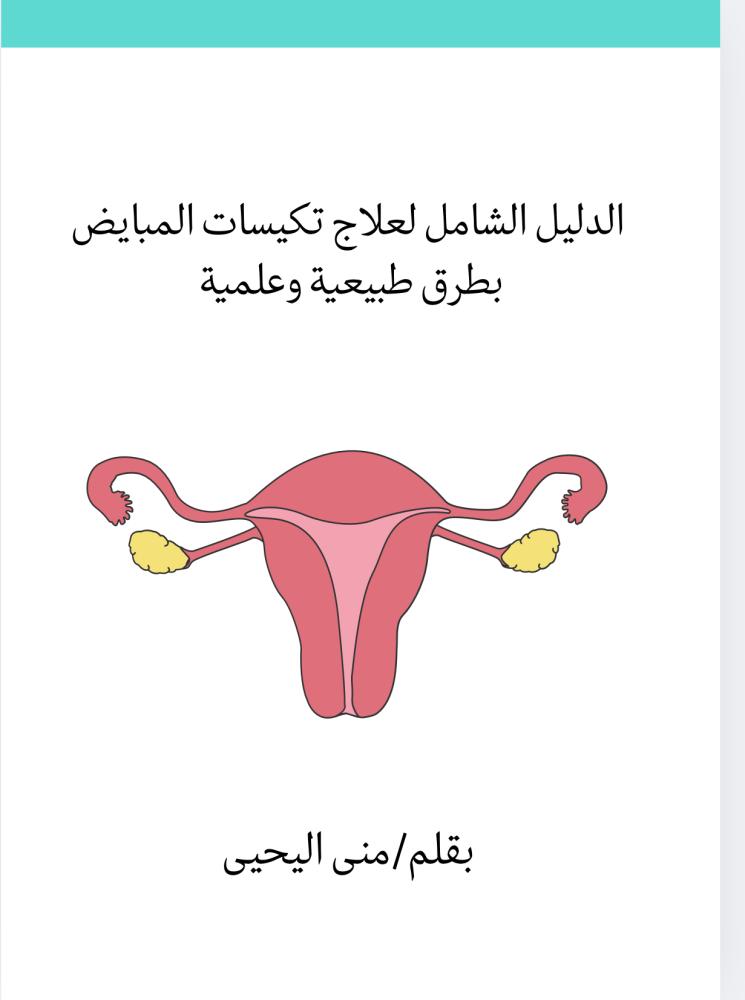 الدليل الشامل لعلاج تكيسات المبايض
