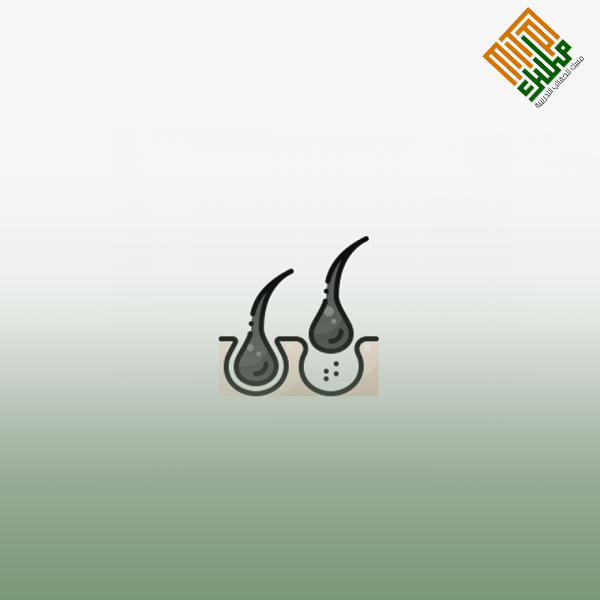 مشاكل الشعر وحلولها