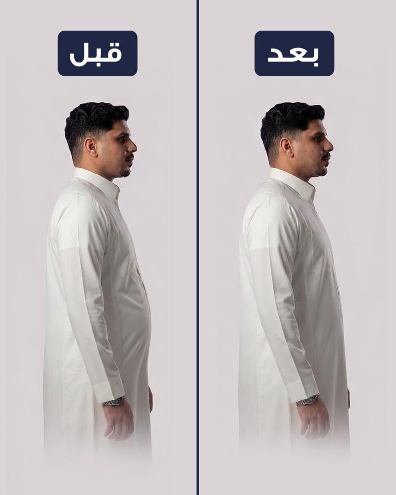 مشد البطن من بيكاتشي مخصص للثوب -  عدد2