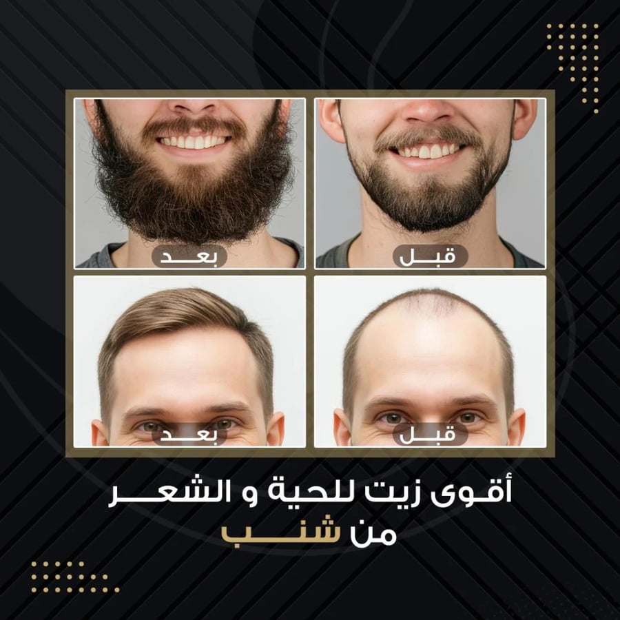 شنب