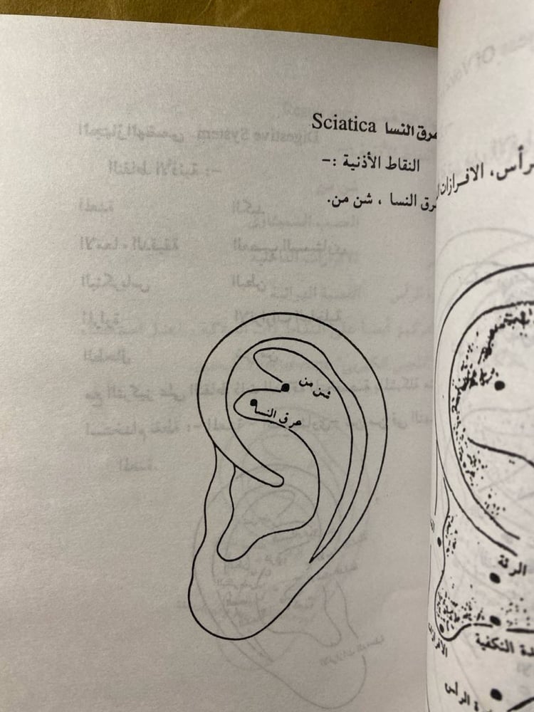 الحجامة نت - هانى على الغزاوى