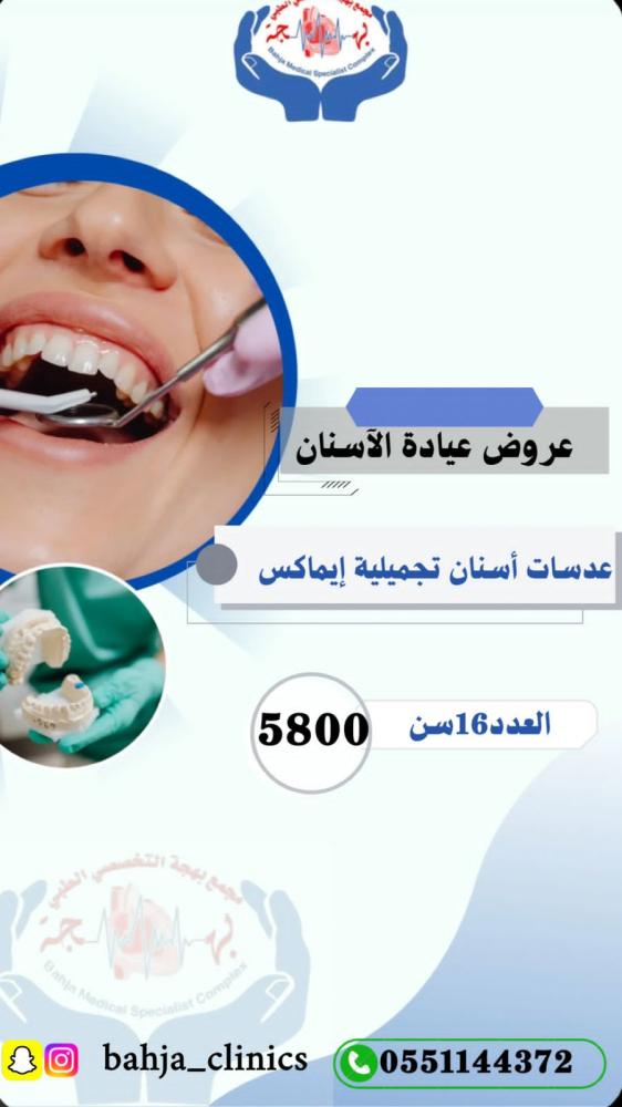 عدسات تجميلية  للأسنان ( 16 سن ايماكس )