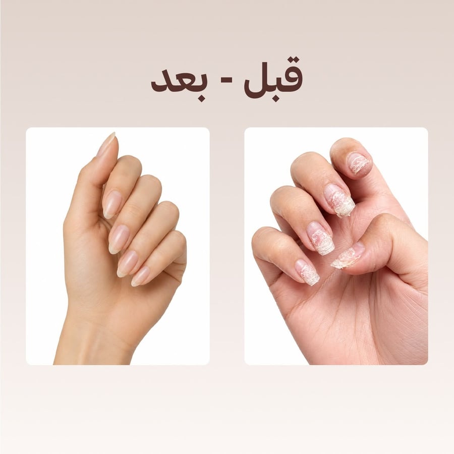 سيروم عناية الأظافر