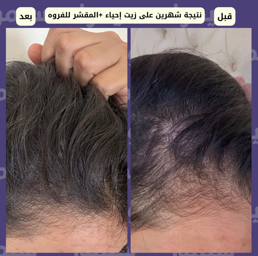 زيت نبيذ الشعر ( اسم الزيت سابقاً إحياء تم تغيير العلبه والاسم وتطوير المنتج للافضل)