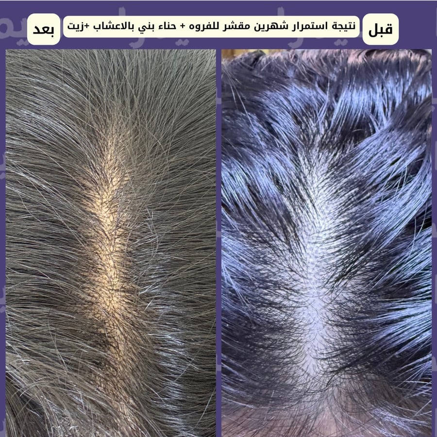 زيت نبيذ الشعر ( اسم الزيت سابقاً إحياء تم تغيير العلبه والاسم وتطوير المنتج للافضل)