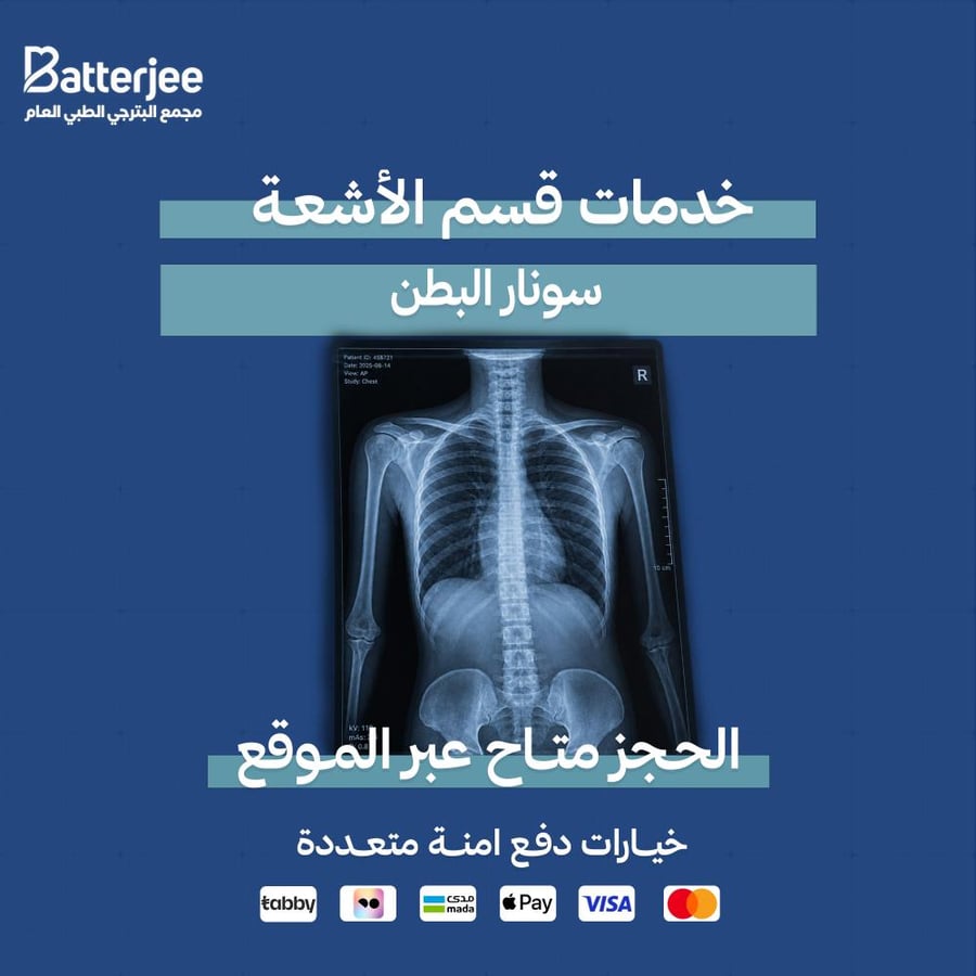 سونار البطن
