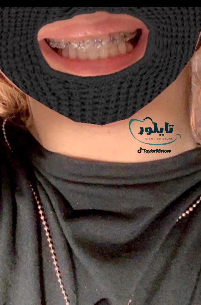 تقويم اسنان فك واحد تركيب بغرا + مطاط مجانا