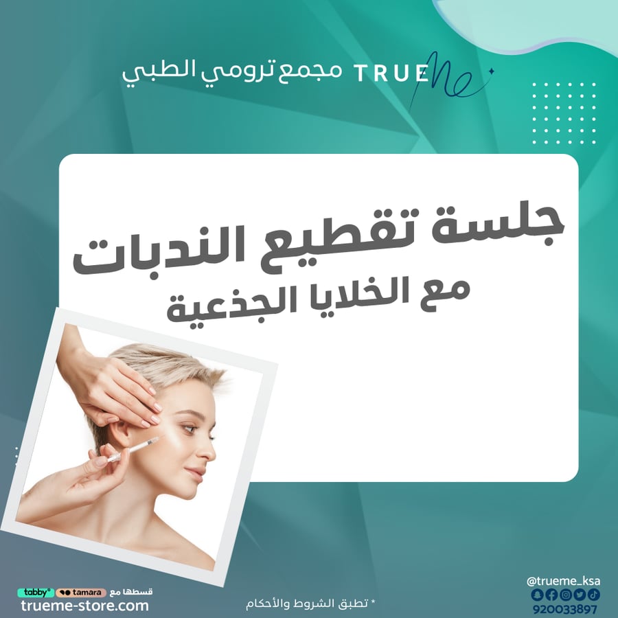 جلسة تقطيع ندبات مع خلايا جذعية
