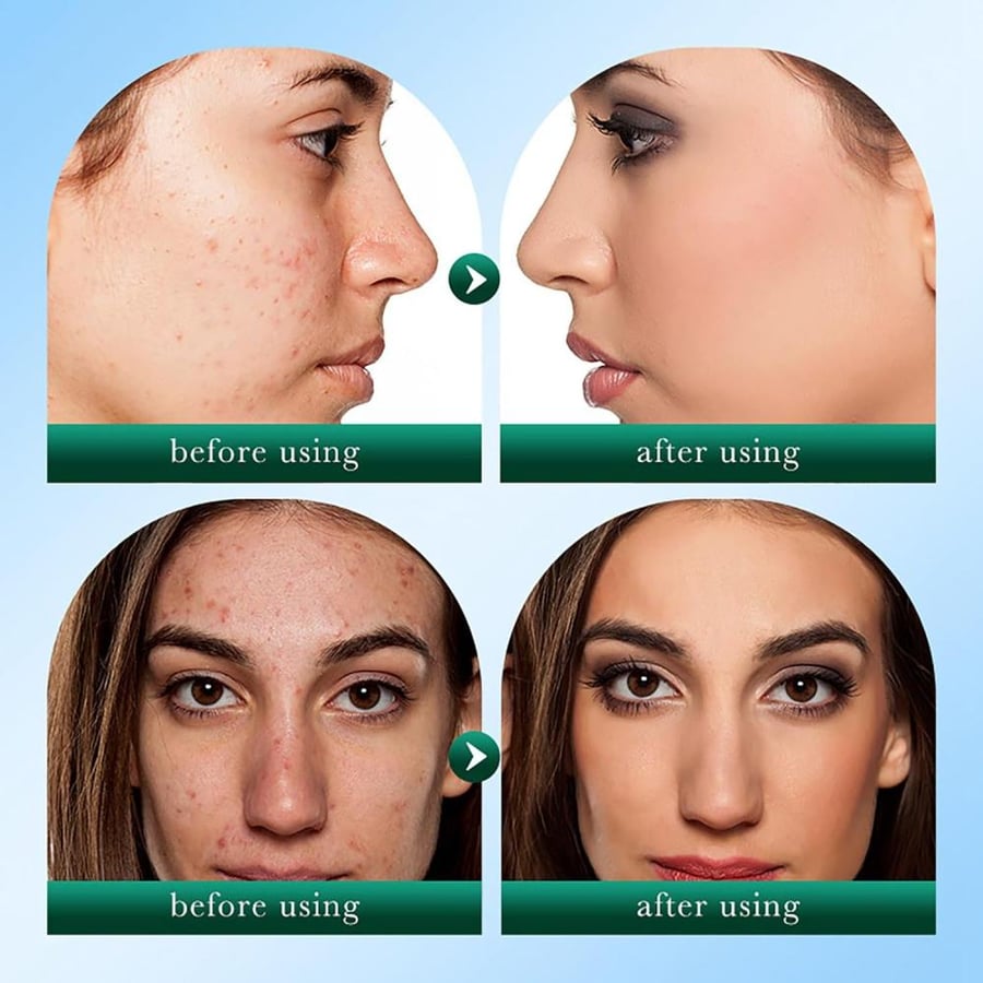 مجموعة شجرة الشاي للعناية بالبشرة كريم عين+ سيروم+كريم وجة+غسول منظف