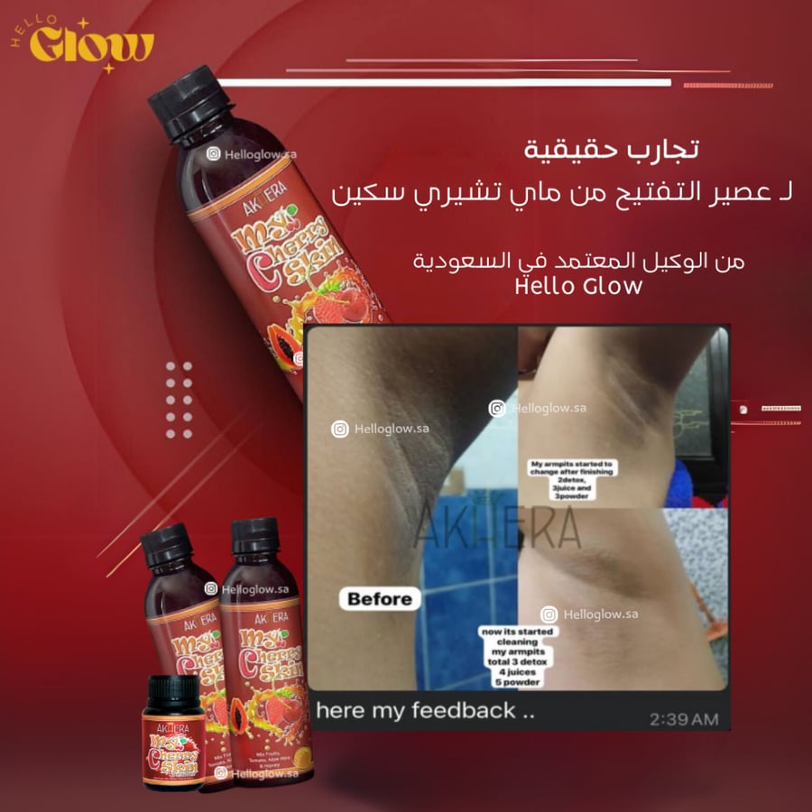 عصير التفتيح من ماي تشيري سكين Akhera My Cherry Skin WHITENING SUPPLEMENT