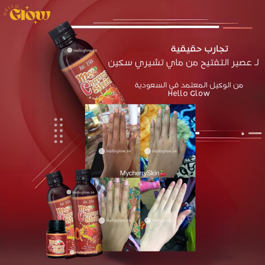 عصير التفتيح من ماي تشيري سكين Akhera My Cherry Skin WHITENING SUPPLEMENT