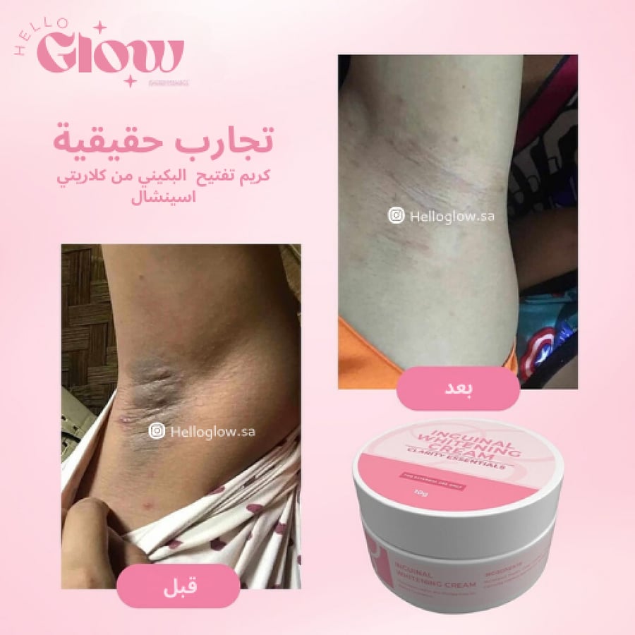 كريم تفتيح خط البكيني من كلاريتي اسينشال - Clarity Essentials Inguinal Whitening Bikini Cream