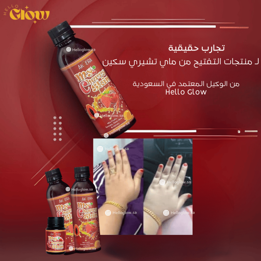 بودرة ماي تشيري سكين - Akhera My Cherry Skin ADVANCED WHITENING SUPPLEMENT