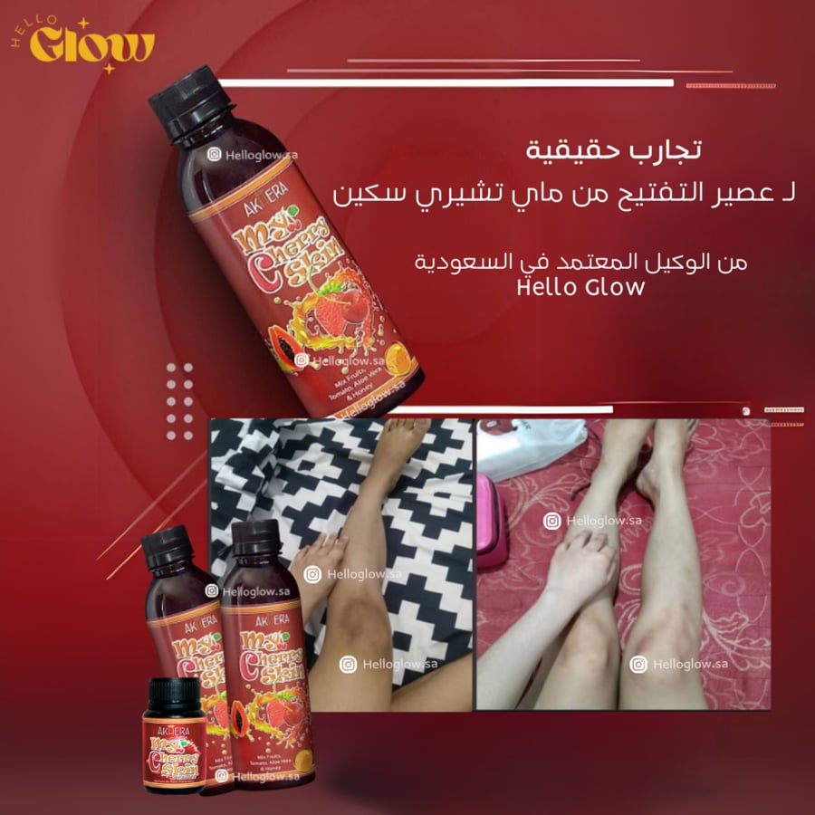 عصير التفتيح من ماي تشيري سكين Akhera My Cherry Skin WHITENING SUPPLEMENT
