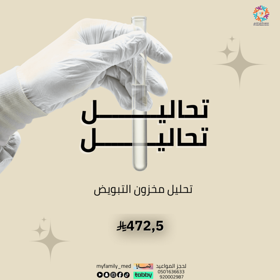 تحليل مخزون التبويض