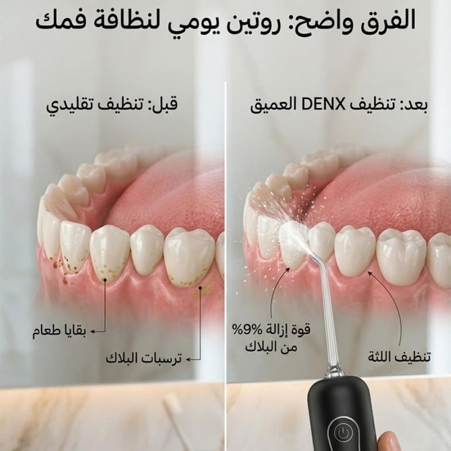 جهاز تنظيف الأسنان بالماء من دينكس لاسلكي IPX7 بخزان 260 مل وأربعة أوضاع ضغط موديل DX3723