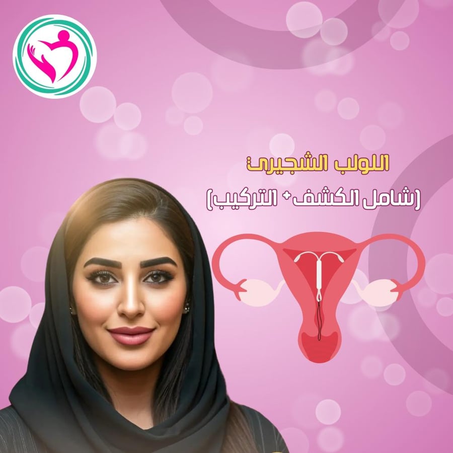 اللولب الشجيري (كشف+تركيب)
