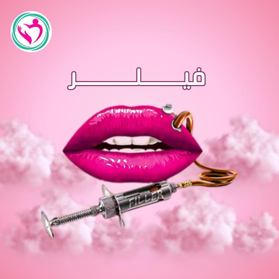 ابرة فيلر