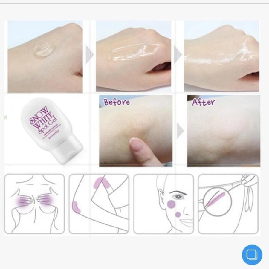 جل سنو وايت لعلاج البقع من سيكريت كي - 65 مل