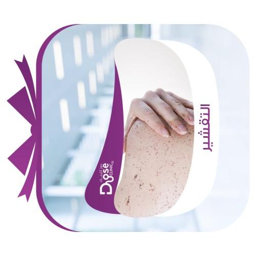 تقشير اسباني للركب و الاكواع