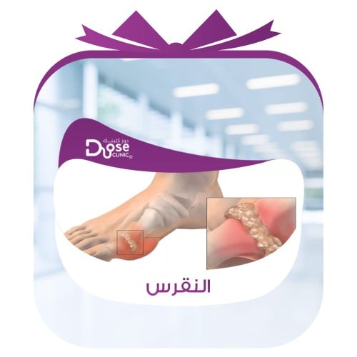 باقة النقرس