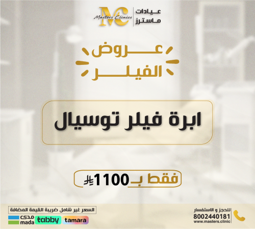 ابرة فيلر توسيال