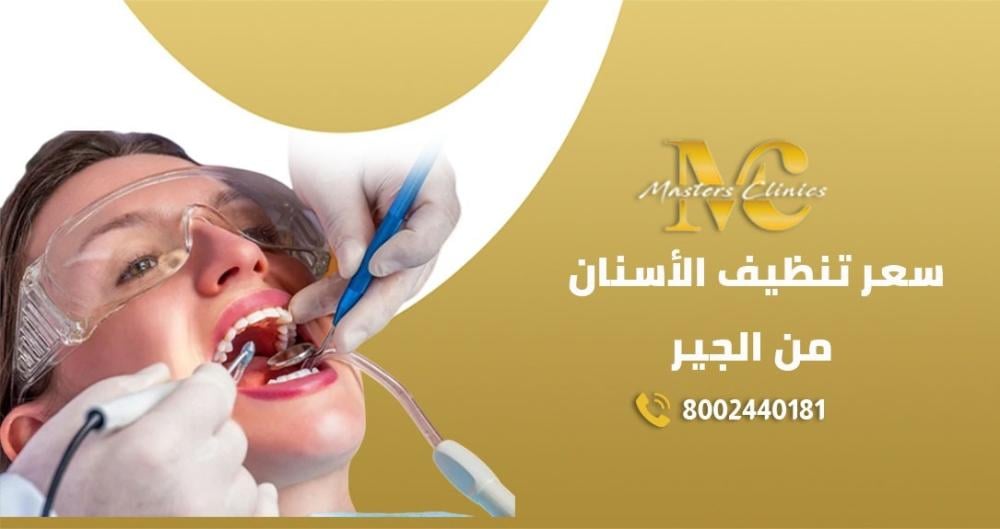 سعر تنظيف الأسنان من الجير