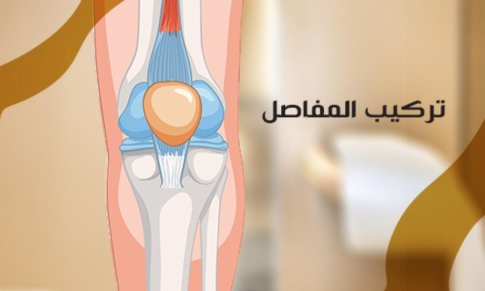 تركيب المفاصل: استعادة الحركة وتقليل الألم بشكل آمن